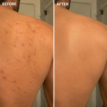 Dermavix's Antifungal Soap